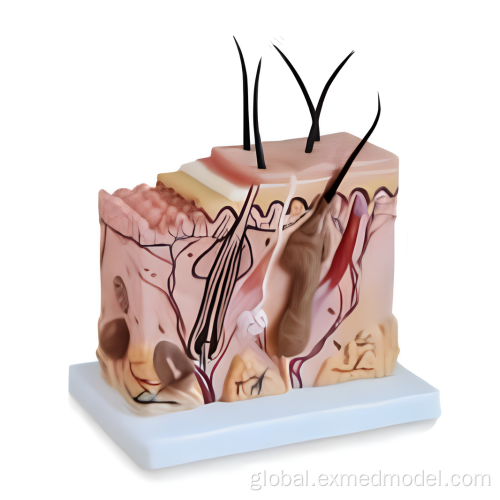 Human Skin Disease Models Skin Block Anatomy Training Model Supplier